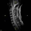 Columna Cervical