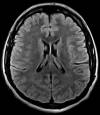 Cerebro