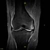 Rodilla