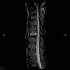 Columna Dorsal
